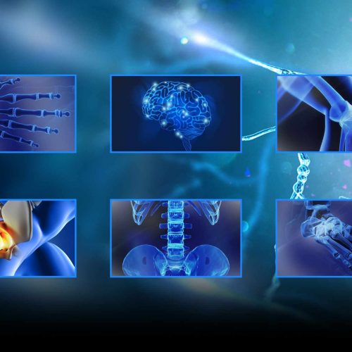 Educational Articles - AANOS